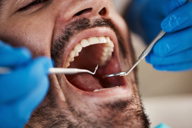 Tooth Infection Emergency Dentist in MN